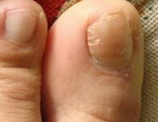 ��ָ����δ�Ⱦ