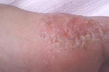 Ϊʲô������Ѣ