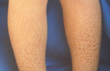 ���۲�������ô���л���