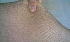 ���۲���ô��