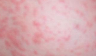 ������Ƥ����ʲô