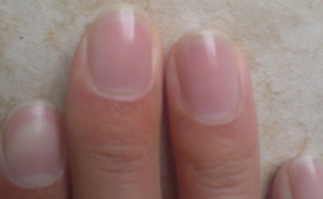 ��ָ�׻᲻�ᴫȾ������