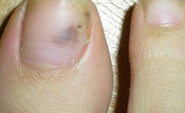 ���ƻ�ָ�׵ķ�������ʲô