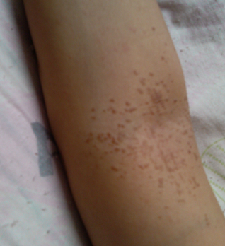 ��ƽ�����ʳע������Щ