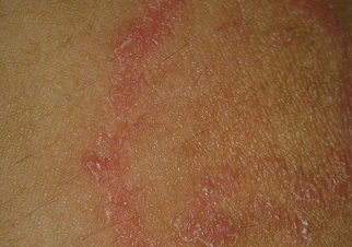 ����ʪ�Ⱦ��