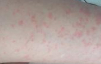 ʪ��ƫ����ȫ