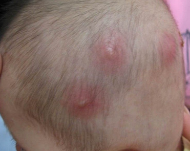 ë����֢״��ʲô��