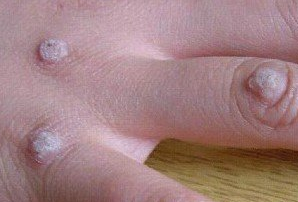 ���߳��ֱ�ƽ�����Ҫԭ��