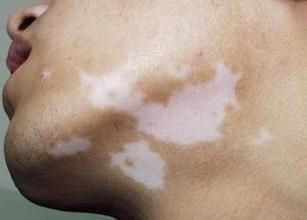 ����֢״������������