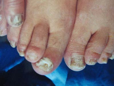 רҵ���ƻ�ָ�׵ķ���