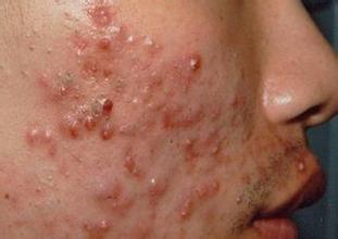 �ഺ��֢״��ͼƬ