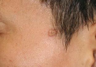 �������α�ƽ��