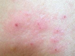 �沿������Ƥ����ô����