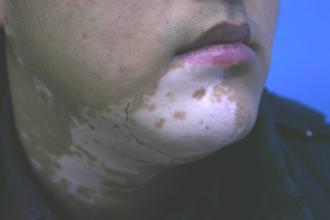 ��������ע�������ʲô