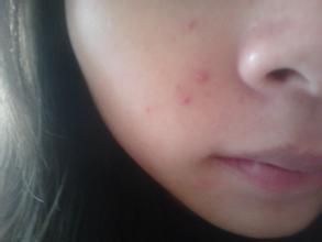 �ഺ����ô