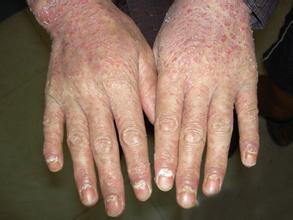 ��������Ѣ��������Щ