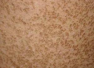 ��������������Ƥ����