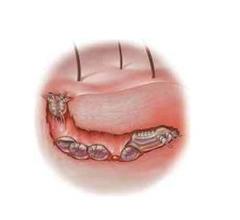 天津治疗疥疮的医院