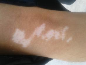 ������Ƥ����ҽԺ�ĸ�����