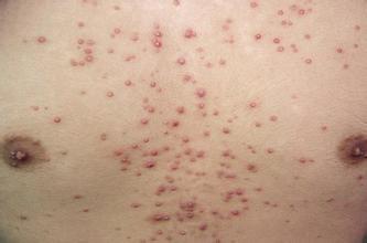 ����ë��������ô�����