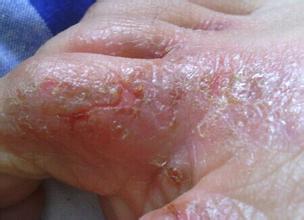 ����Ѣ���κ���