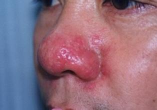 �����ʲôԭ��