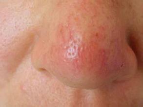 ���������ô�����