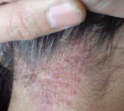 �������֬����Ƥ����ô��