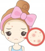 天津哪里治疗青春痘比较好