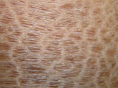 天津鱼鳞病医院哪家好